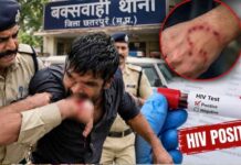 MP में दुष्कर्म के फरार आरोपी की हरकत, कांस्टेबल को काटने के बाद HIV संक्रमण का खुलासा